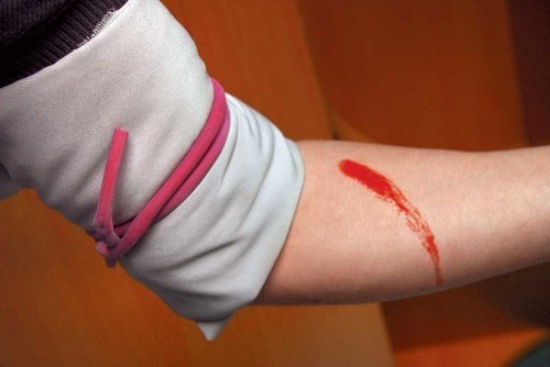 Как остановить кровотечение  при ранении
