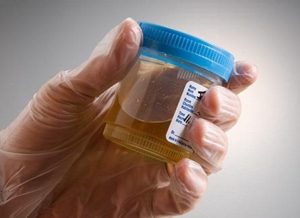 How to collect urine for analysis