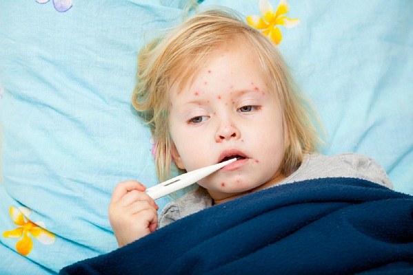 Why get sick with chicken pox only once in life