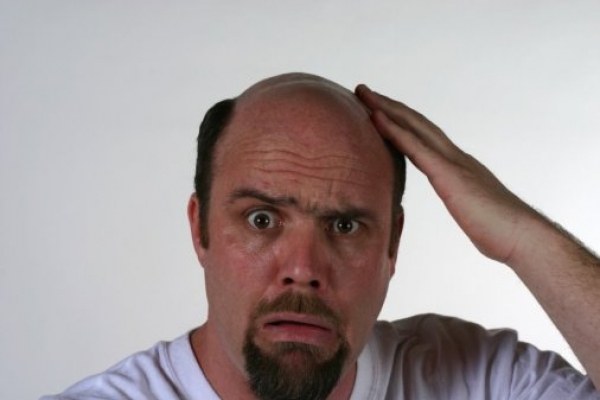 Bald men: how to restore hair