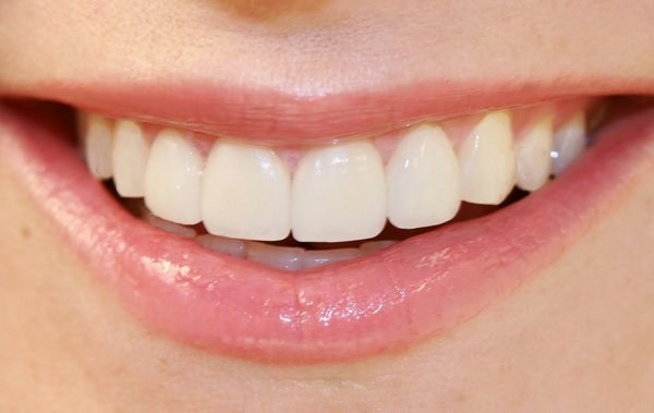 Идеальные зубы человека фото
