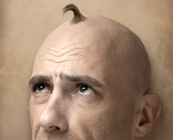 Почему выпадают волосы у мужчин