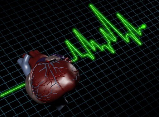 Какие последствия инфаркта
