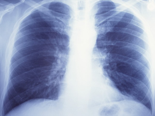 How to get rid of heaviness in the lungs