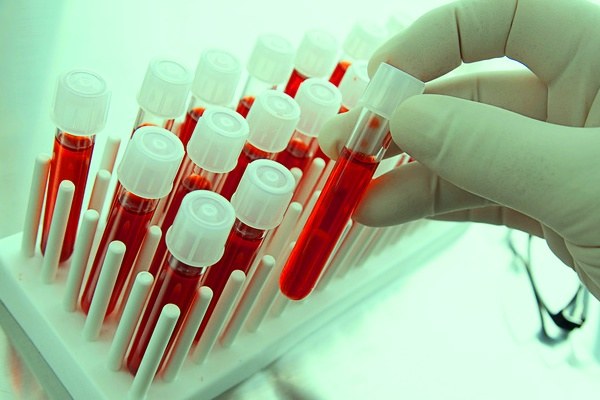 A blood test for cancer: abnormalities