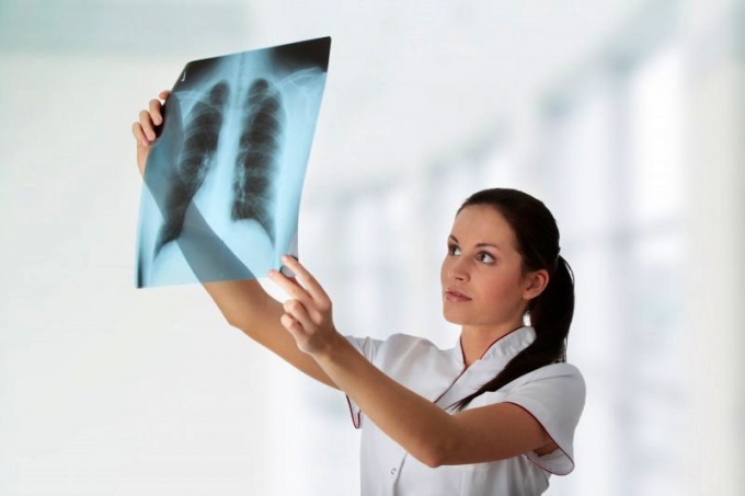 How often do x-rays