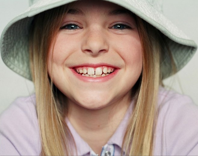 Как понять что у ребенка лезут зубы фото
