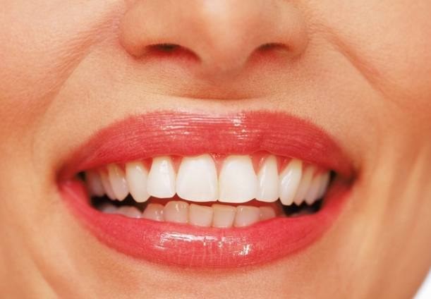 Как защитить передние зубы от кариеса