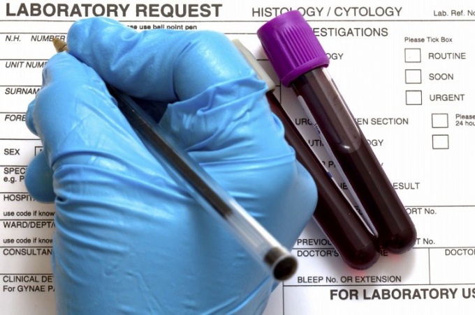 Расшифровка анализа крови на онкомаркеры