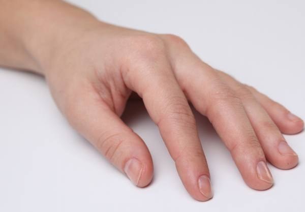 Problems with nails: who to contact