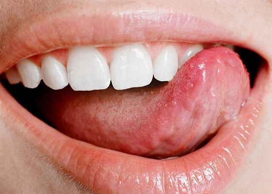 Sores under tongue: how to treat