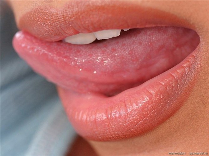 Inflammation of taste buds - a common disease of the oral cavity