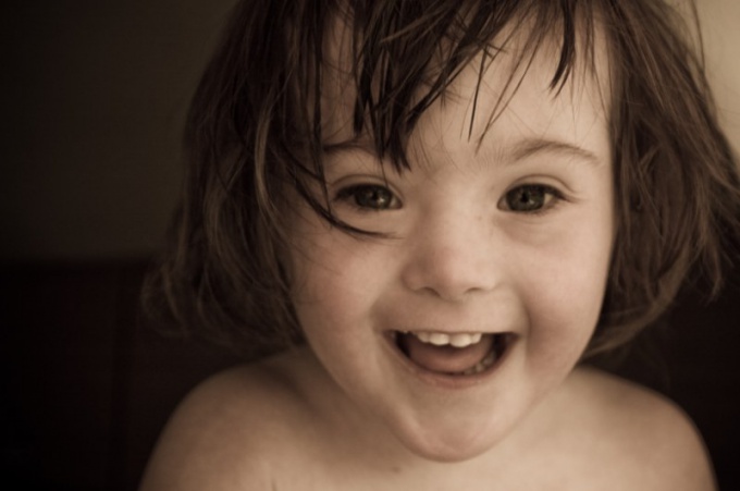 Is down syndrome a hereditary disease