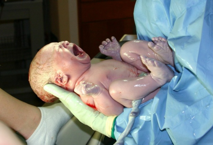 Фото Сразу После Рождения