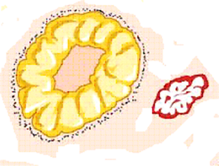 Regression of the corpus luteum