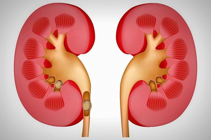 According to medstatistiki, seven out of ten people aged 20 to 50 years already have the first signs of the formation of kidney stones, although they do not even suspect...