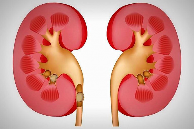 Согласно медстатистике, у семи из десяти человек в возрасте от 20 до 50 лет уже есть первые признаки формирования камней в почках, хотя они этого даже не подозревают…