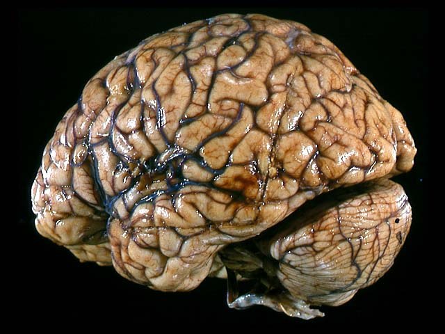 Как выглядит мозг человека