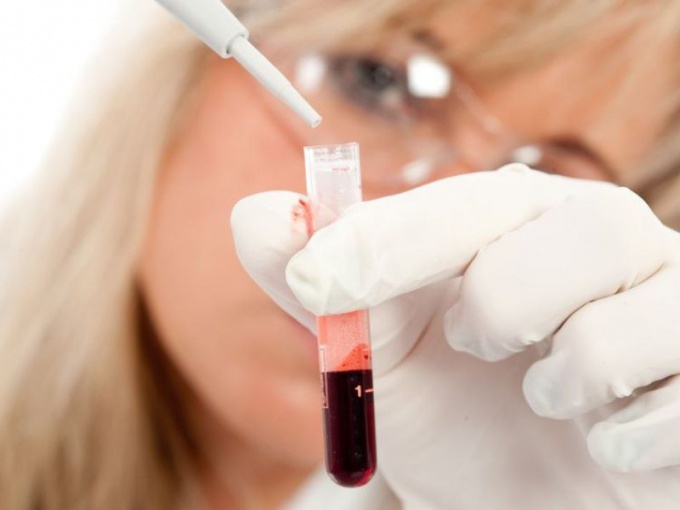 What kind of diseases can be recognized by blood and urine tests