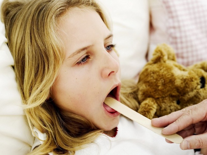 Как вылечить сухой кашель у ребенка 