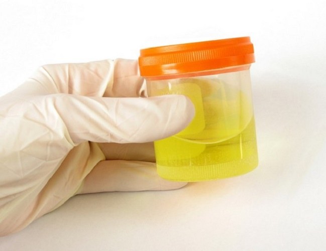 How to collect a urine sample for Sulkowice 