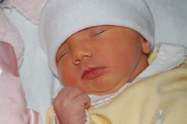 Elevated bilirubin in newborn: causes and treatment