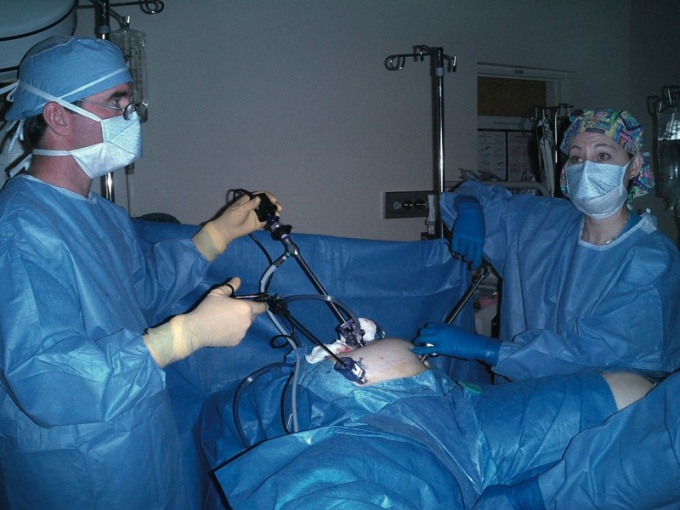 Diagnosis of obstruction of the fallopian tubes by laparoscopy