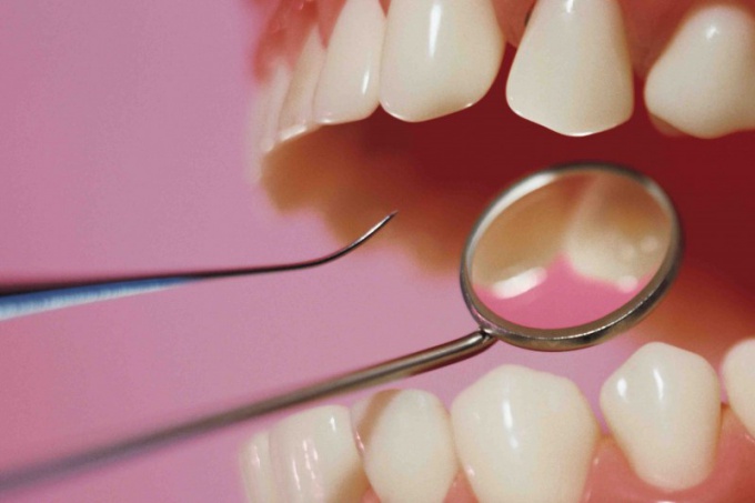 Как отбелить зубы у дантиста