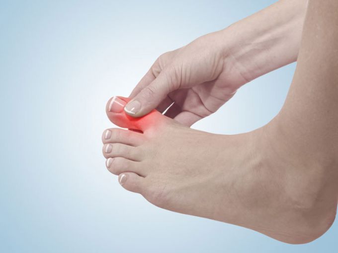Как лечить ушиб пальца на ноге