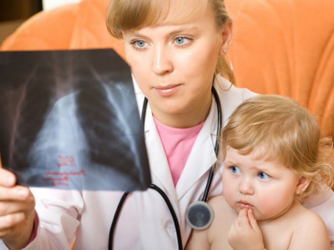Пневмония у ребенка: симптомы, признаки, лечение 