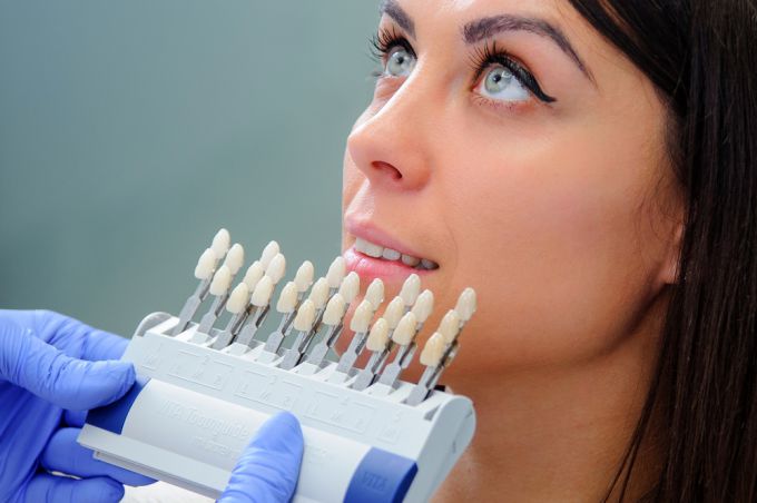 Виды зубных имплантов, их плюсы и минусы