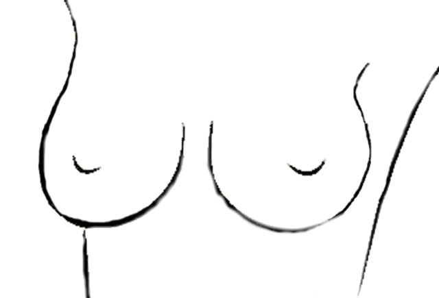 Как привести в форму грудь после прекращения лактации