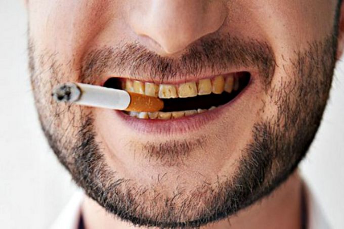 Налет на зубах после курения