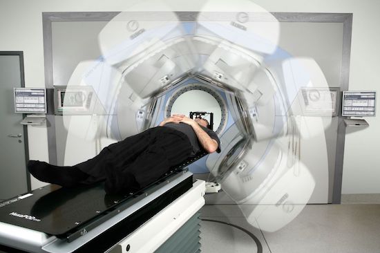 Радиотерапия опухоли головного мозга. Облучение системой VMAT
