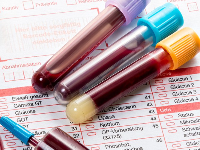 WBC в анализе крови: расшифровка показаний