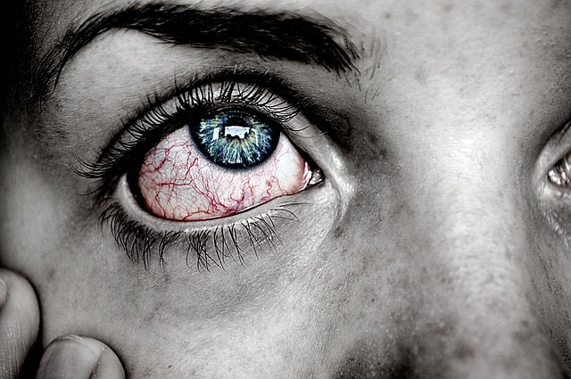 Как избавиться от воспаления глаз