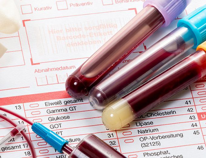 Люди с какой группой крови чаще заражаются коронавирусом